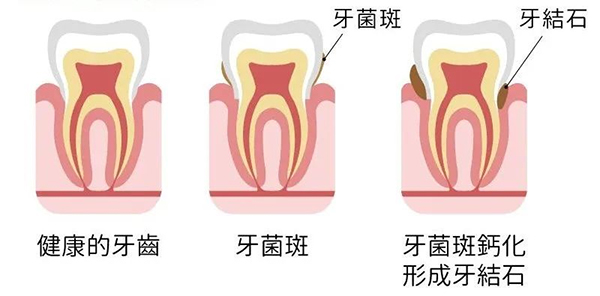 图片-1.jpg